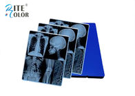 CT씨 장비 이미지 산출을 위한 파란 레이저 엑스레이 영화 디지털 방식으로 엑스레이 영화
