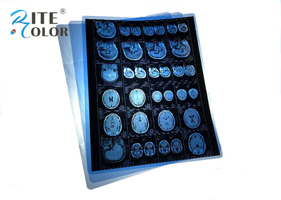 방수 PET 블루 의료 엑스레이 필름 MRI CT CR 치아 파노라마 이미지 출력